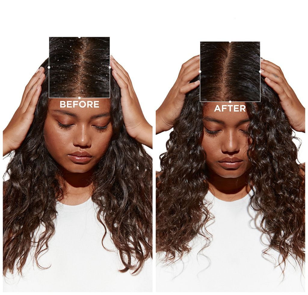 Kerastase Symbiose Bain Purete Anti-Pelliculaire Purifying Anti-Dandruff Cellular Shampoo แชมพูสูตรอ่อนโยน เนื้อเจลใส ลดปัญหารังแค 250 ml