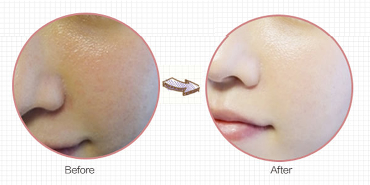 กันแดด (Sun screen SPF 40 PA+++)